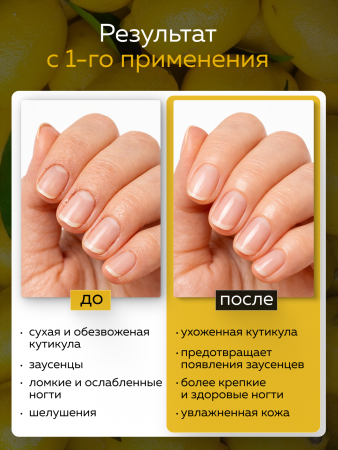 Масло укрепляющее двухфазное для ногтей Lemon, Global Fashion, 60 мл